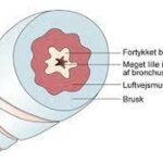 Crown Bubble Denmark Crown Bubble Denmark